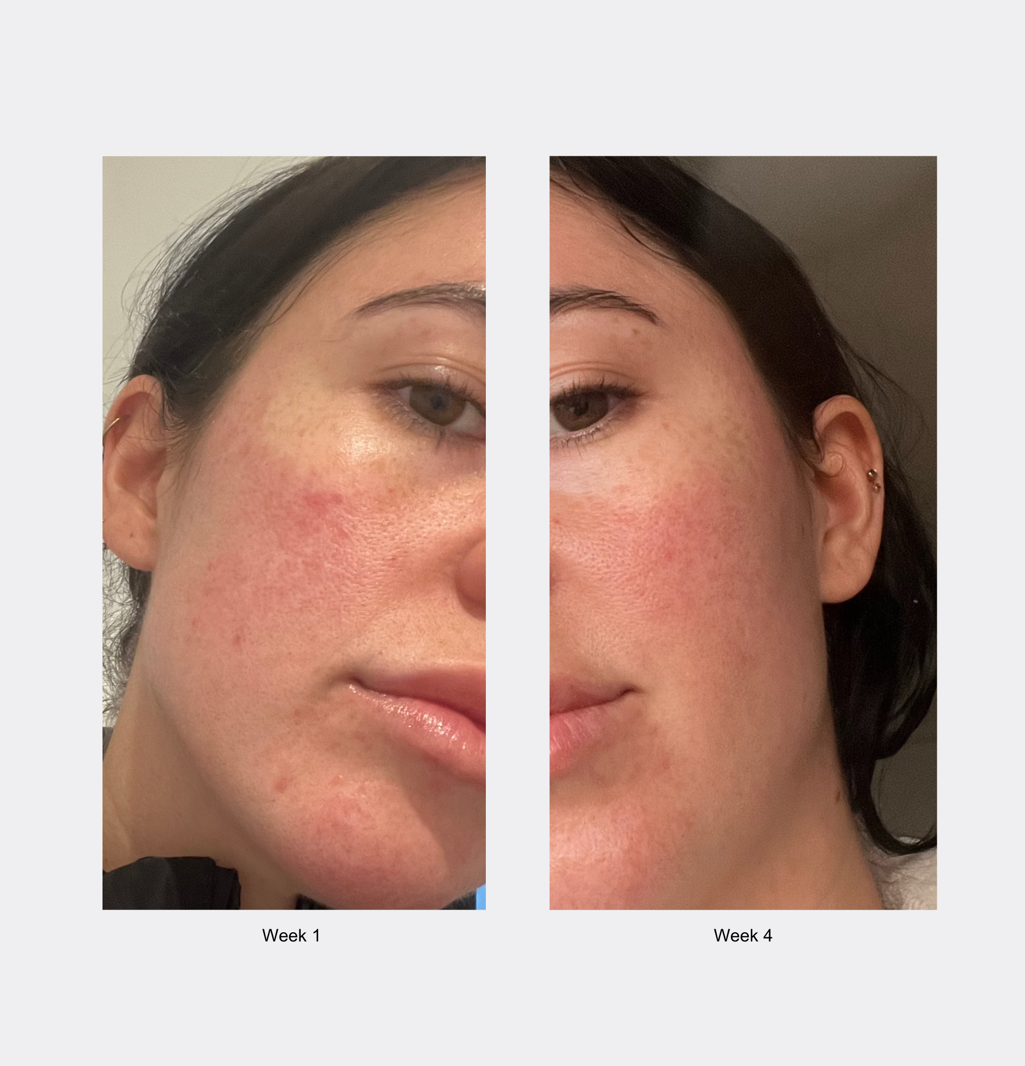 Foile - Daily Jelly Moisturiser