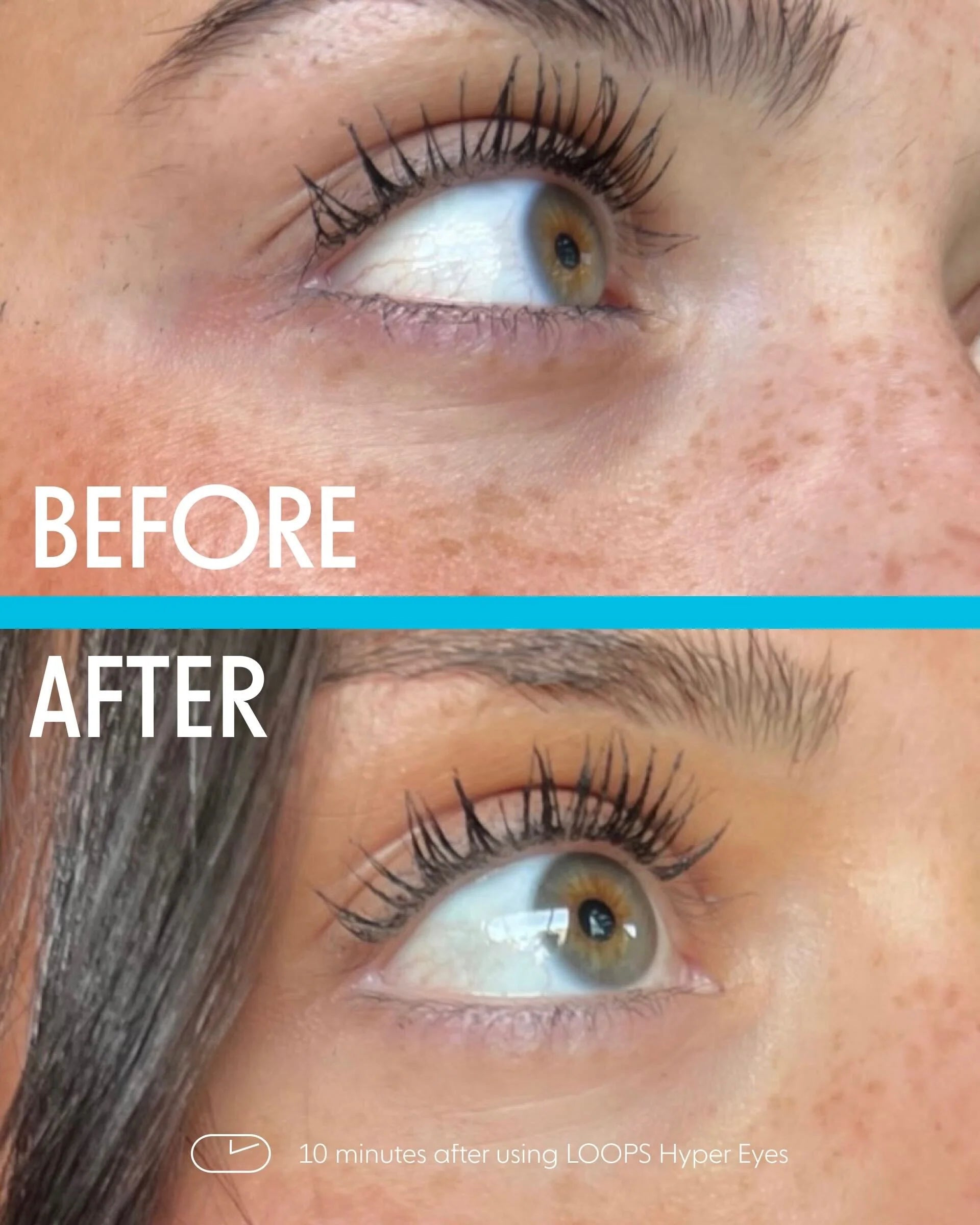 LOOPS - Hyper Eyes Hydrogel Under Eye Mask